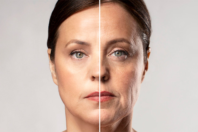 Comparación de un rostro antes y después de recibir un tratamiento antiaging