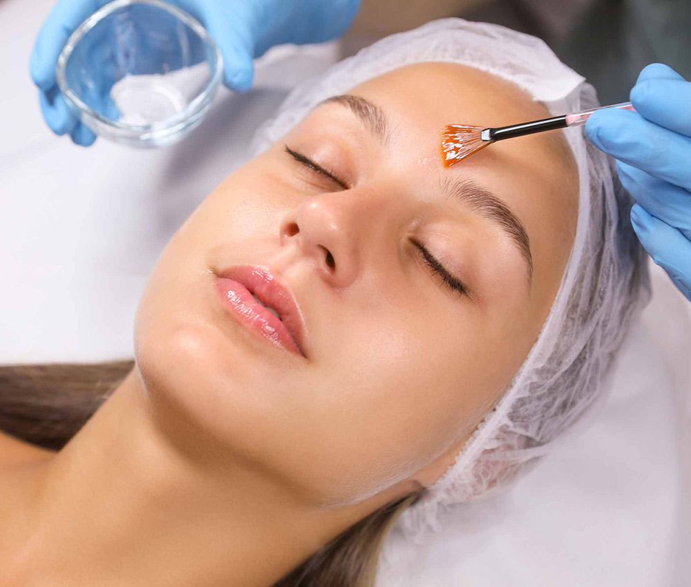 Mujer recibiendo un tratamiento de peeling químico sobre su rostro